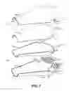 Fig. 03 - Uterine clamp