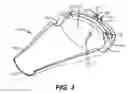 Fig. 04 - Uterine clamp