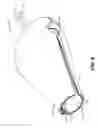 Fig. 06 - Uterine clamp