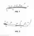 Fig. 02 - Implantable tissue fastener and system for treating a gastrointestinal tract