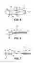 Fig. 04 - Implantable tissue fastener and system for treating a gastrointestinal tract
