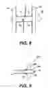 Fig. 05 - Implantable tissue fastener and system for treating a gastrointestinal tract