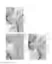 Fig. 10 - CELLULOSE SUTURE AND METHOD FOR GRADUAL VESSEL OCCLUSION USING THE SAME