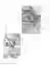 Fig. 11 - CELLULOSE SUTURE AND METHOD FOR GRADUAL VESSEL OCCLUSION USING THE SAME
