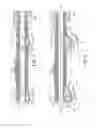 Fig. 02 - Rotational atherectomy device with fluid inflatable support elements and two torque transmitting coils