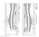 Fig. 09 - Rotational atherectomy device with fluid inflatable support elements and two torque transmitting coils