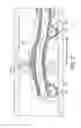 Fig. 16 - Rotational atherectomy device with fluid inflatable support elements and two torque transmitting coils