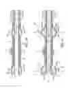 Fig. 27 - Rotational atherectomy device with fluid inflatable support elements and two torque transmitting coils