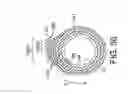 Fig. 32 - Rotational atherectomy device with fluid inflatable support elements and two torque transmitting coils