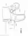 Fig. 12 - HAND ACTIVATED SURGICAL INSTRUMENT