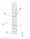 Fig. 04 - Tissue Removal Apparatus and Method of Manufacturing Same