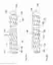 Fig. 06 - Tissue Removal Apparatus and Method of Manufacturing Same
