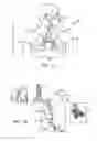 Fig. 02 - Lung volume reduction devices, methods, and systems