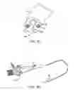 Fig. 05 - Lung volume reduction devices, methods, and systems