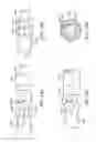 Fig. 14 - Lung volume reduction devices, methods, and systems