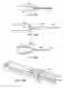 Fig. 17 - Lung volume reduction devices, methods, and systems