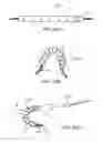 Fig. 29 - Lung volume reduction devices, methods, and systems
