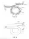 Fig. 35 - Lung volume reduction devices, methods, and systems