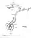 Fig. 40 - Lung volume reduction devices, methods, and systems