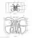 Fig. 02 - Method of dilating tissue of a sinus drainage pathway