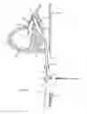Fig. 05 - Method of dilating tissue of a sinus drainage pathway