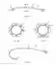 Fig. 06 - Method of dilating tissue of a sinus drainage pathway