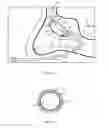 Fig. 07 - Method of dilating tissue of a sinus drainage pathway