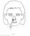Fig. 12 - Method of dilating tissue of a sinus drainage pathway