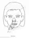 Fig. 13 - Method of dilating tissue of a sinus drainage pathway