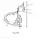 Fig. 35 - Method of dilating tissue of a sinus drainage pathway