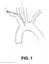Fig. 02 - Method of isolating the cerebral circulation during a cardiac procedure