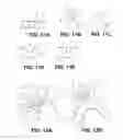 Fig. 18 - Method of isolating the cerebral circulation during a cardiac procedure