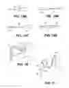 Fig. 20 - Method of isolating the cerebral circulation during a cardiac procedure