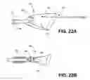 Fig. 25 - Method of isolating the cerebral circulation during a cardiac procedure