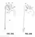Fig. 27 - Method of isolating the cerebral circulation during a cardiac procedure