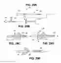 Fig. 35 - Method of isolating the cerebral circulation during a cardiac procedure