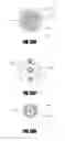 Fig. 40 - Method of isolating the cerebral circulation during a cardiac procedure