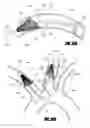 Fig. 41 - Method of isolating the cerebral circulation during a cardiac procedure