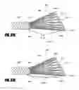 Fig. 48 - Method of isolating the cerebral circulation during a cardiac procedure