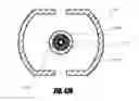 Fig. 59 - Method of isolating the cerebral circulation during a cardiac procedure