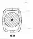 Fig. 61 - Method of isolating the cerebral circulation during a cardiac procedure