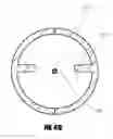 Fig. 62 - Method of isolating the cerebral circulation during a cardiac procedure