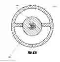 Fig. 63 - Method of isolating the cerebral circulation during a cardiac procedure