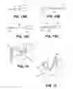 Fig. 20 - Steerable dual filter cerebral protection system
