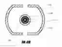 Fig. 59 - Steerable dual filter cerebral protection system