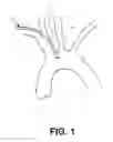 Fig. 02 - Method of accessing the left common carotid artery