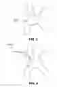 Fig. 09 - Method of accessing the left common carotid artery