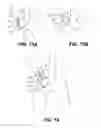 Fig. 19 - Method of accessing the left common carotid artery