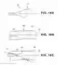 Fig. 23 - Method of accessing the left common carotid artery