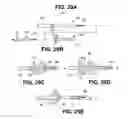 Fig. 35 - Method of accessing the left common carotid artery